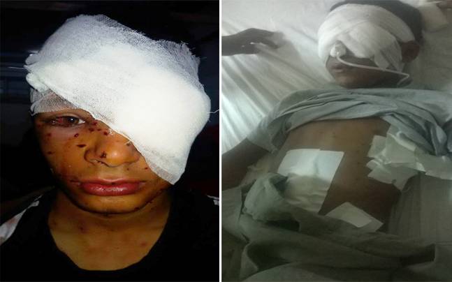 Kasjmir: minstens 100 mensen blind vanwege door politie afgeschoten metaaldeeltjes….. Koenders? Zoals gewoonlijk doodstil!